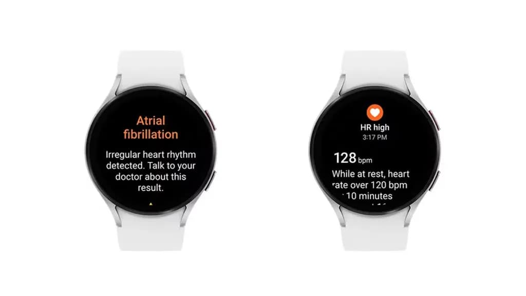 smartwatch
