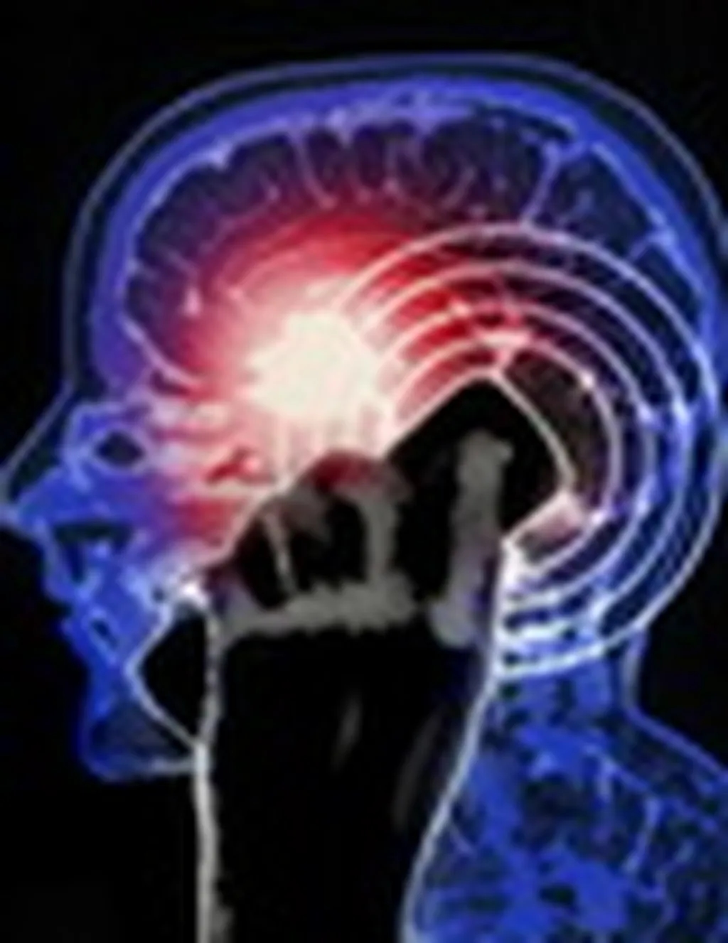 آیا مکالمه بلند مدت با تلفن های همراه تاثیری بر مغز دارد؟